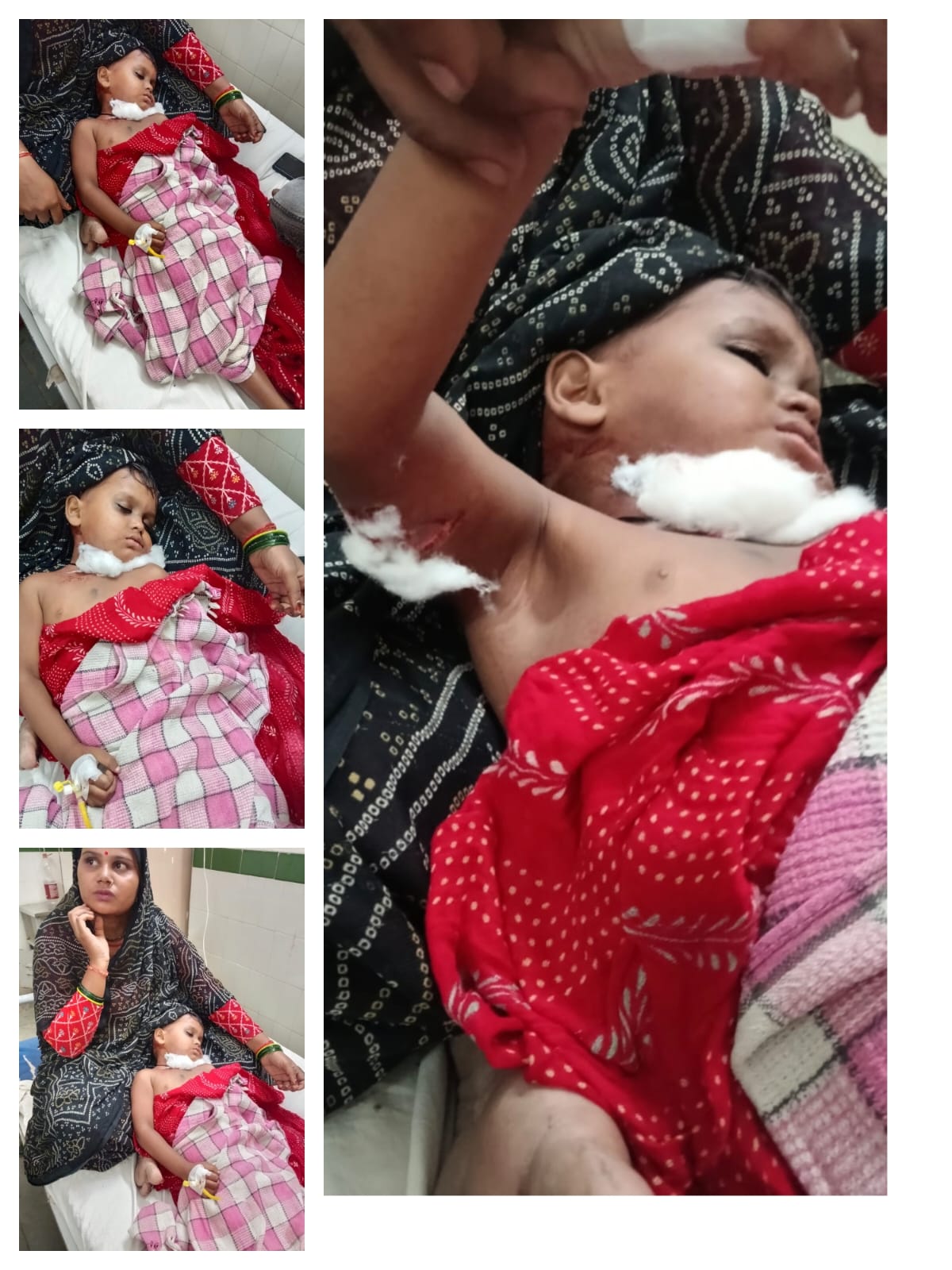 వీధి కుక్కల నియంత్రణపై అధికారుల నిర్లక్ష్యం.. ప్రజల ఆందోళన