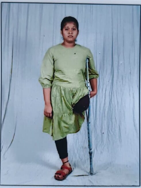 ఒంటి కాలుతో విద్యాభ్యాసం… కృత్రిమ కాలు కోసం ఎదురుచూపులు